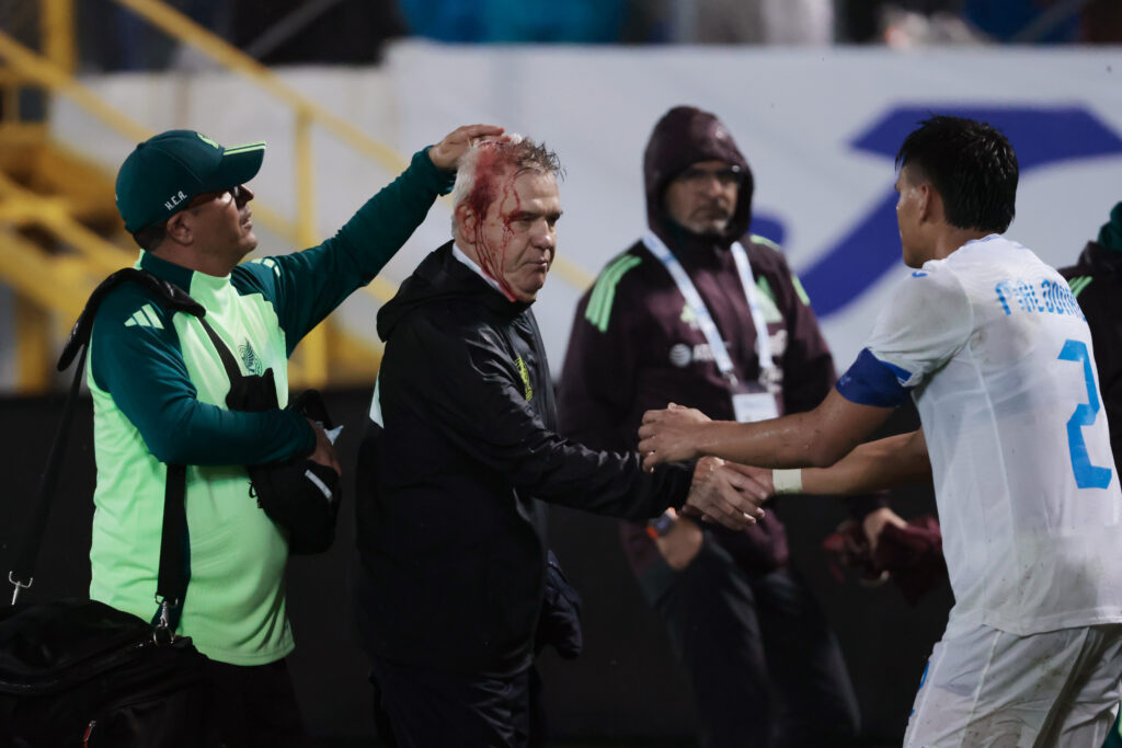 Follia al termine di Honduras-Messico: ferito Aguirre